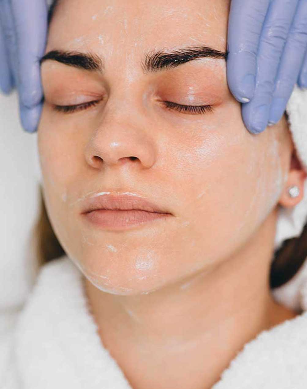 skin-peel-offer-oct