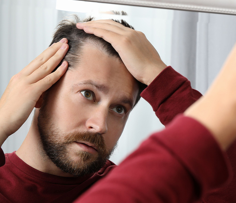 man-Hair-Restoration